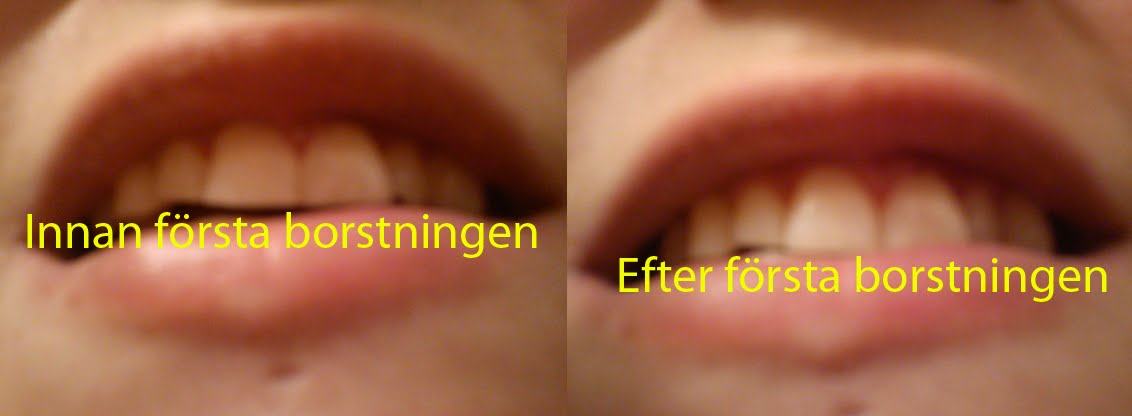 pepsodent white now gold test
